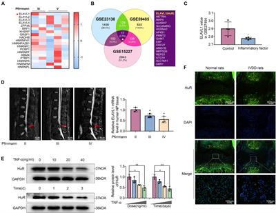 RNA-Binding Protein HuR Suppresses Inflammation and Promotes Extracellular Matrix Homeostasis via NKRF in Intervertebral Disc Degeneration